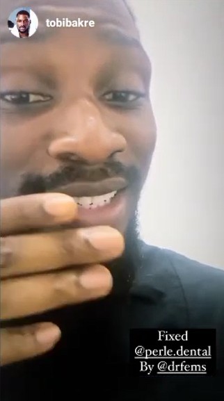 Teeth Whitening Procedure